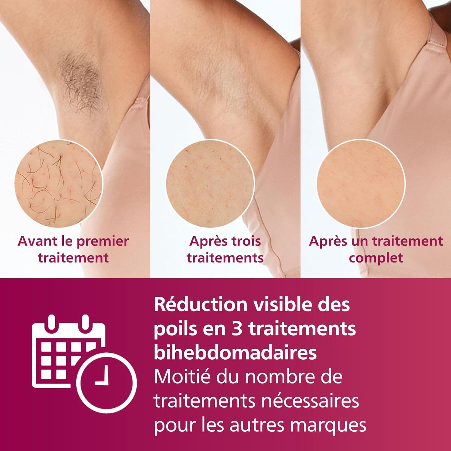 Philips Lumea série 7000, Épilateur à lumière pulsée, alternative à l'épilation laser, 3 embouts pour le corps, le visage et le maillot, modèle SC1999/00